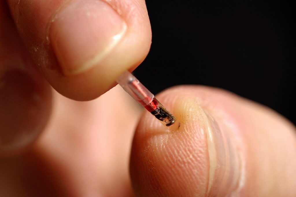 Would You Get a Microchip Under Your Skin?