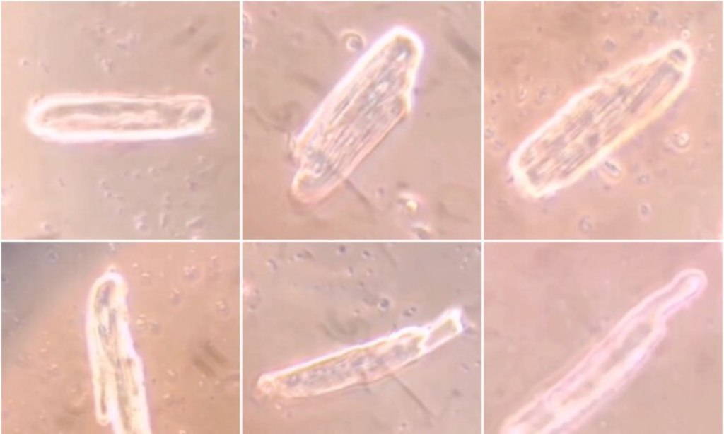 mRNA COVID Vaccines Form Spike Protein in Heart Cells, but Cause Different Anomalies: Research Article