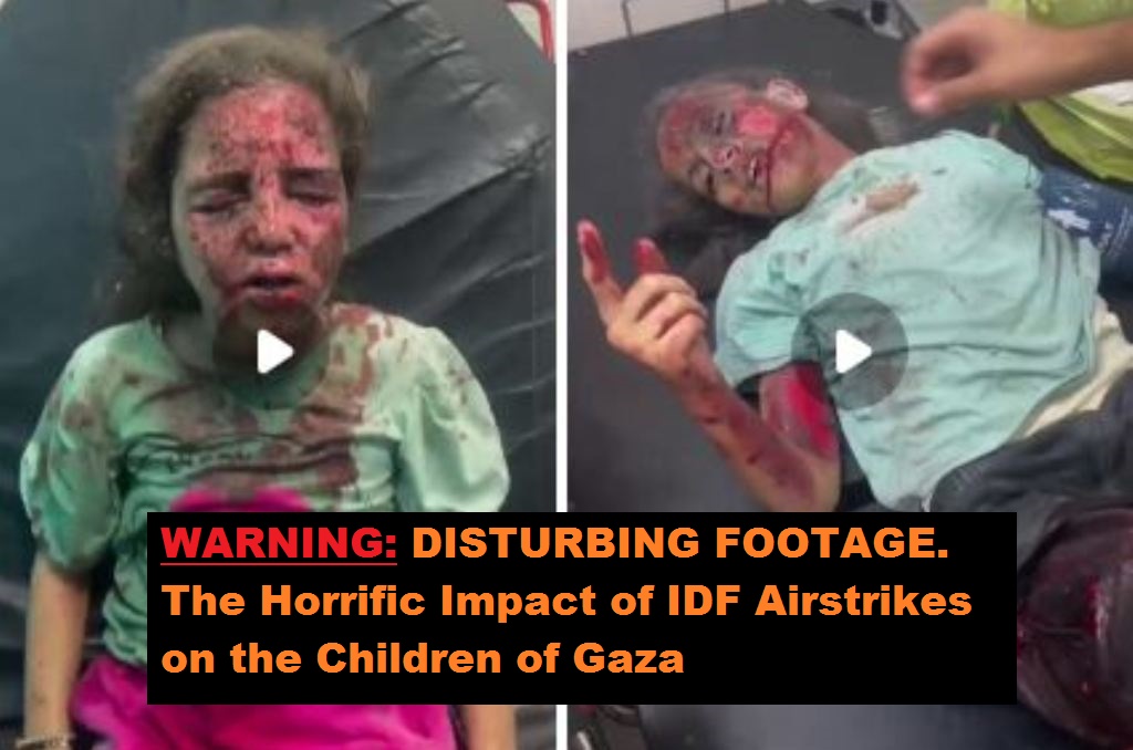WARNING: DISTURBING FOOTAGE. The Horrific Impact of IDF Airstrikes on the Children of Gaza