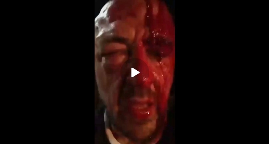 Prominent Italian Chef Rubio, who has been Vocal about his Support of Palestine has Posted to his Social Media Stating he was Ambushed and Violently Attacked Outside of His Home