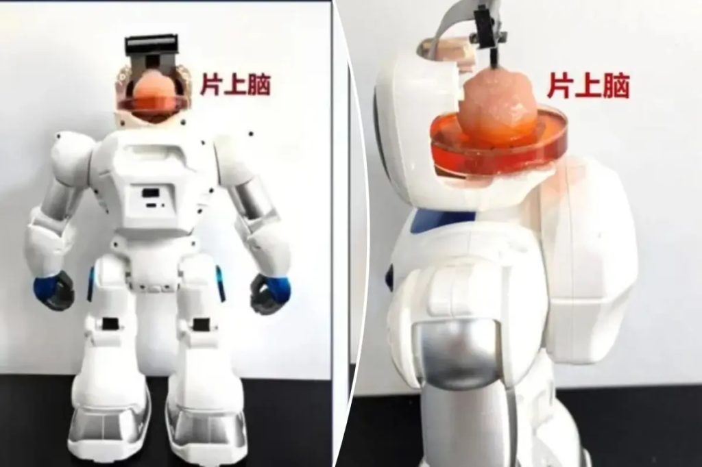 Chinese Scientists Grew a “Cerebral Organoid” — A Mini Brain Made From Human Stem Cells — and Connected It to a Robot